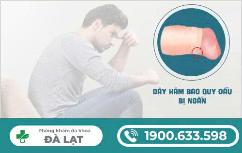 Hình ảnh minh họa